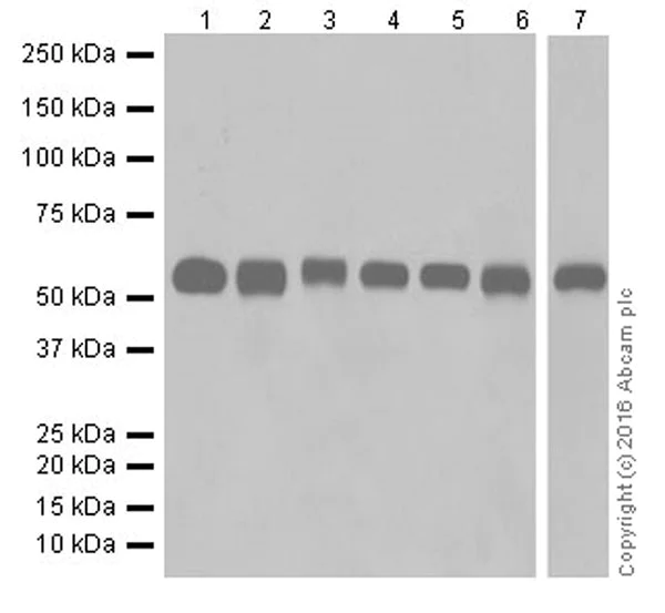 Western blot - Anti-USP22 antibody [EPR18945] (AB195289)