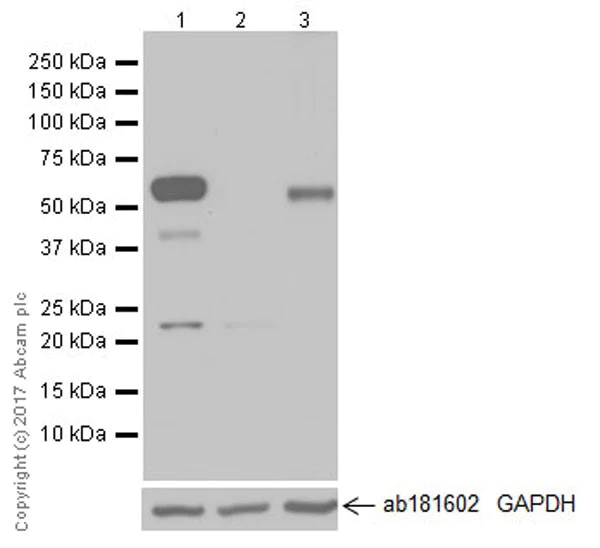Western blot - Anti-USP22 antibody [EPR18945] (AB195289)