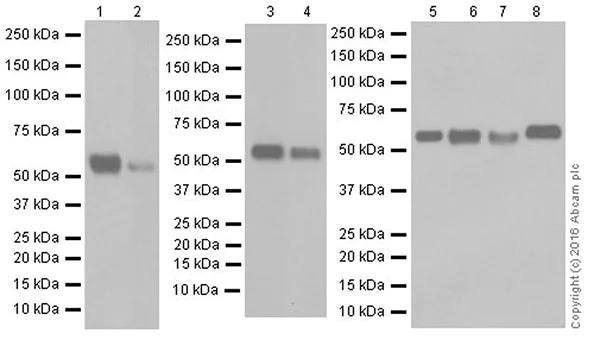 Western blot - Anti-USP22 antibody [EPR18945] (AB195289)