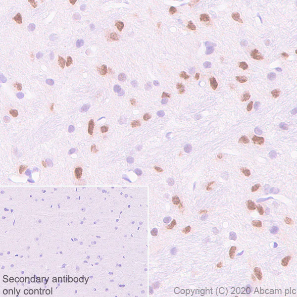 Immunohistochemistry (Formalin/PFA-fixed paraffin-embedded sections) - Anti-USP22 antibody [EPR18945] - BSA and Azide free (AB238948)