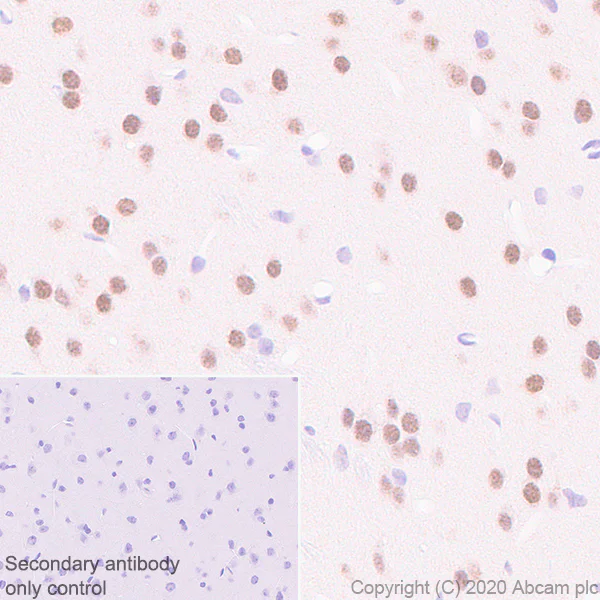 Immunohistochemistry (Formalin/PFA-fixed paraffin-embedded sections) - Anti-USP22 antibody [EPR18945] - BSA and Azide free (AB238948)