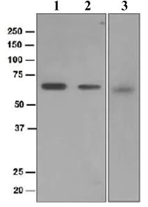 Western blot - Anti-USP22 antibody [EPR4352(2)] (AB109435)