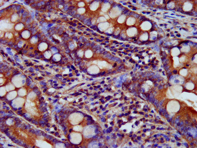 Immunohistochemistry (Formalin/PFA-fixed paraffin-embedded sections) - Anti-USP24 antibody (AB238842)