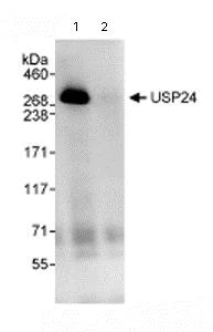 Immunoprecipitation - Anti-USP24 antibody (AB72241)