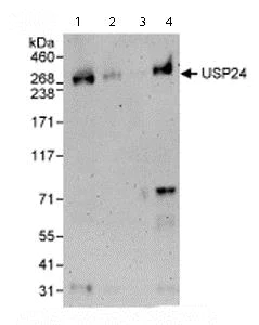 Western blot - Anti-USP24 antibody (AB72241)
