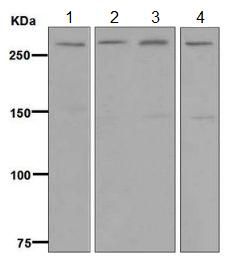 Western blot - Anti-USP24 antibody [EPR7060] (AB129064)