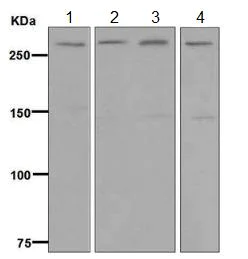 Western blot - Anti-USP24 antibody [EPR7060] (AB129064)