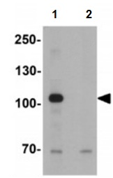 Western blot - Anti-USP25 antibody (AB191703), expandable thumbnail