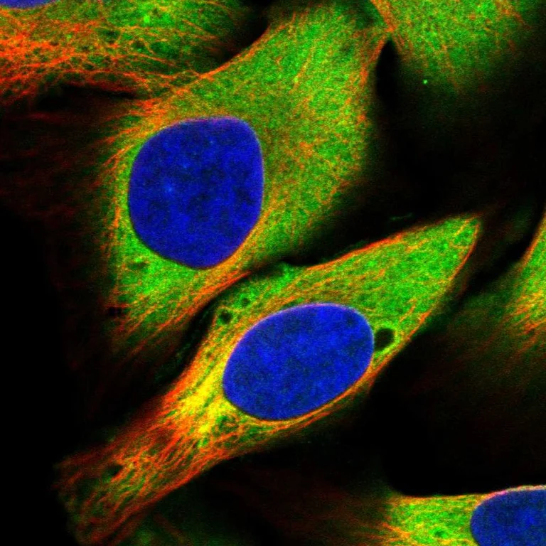 Immunocytochemistry/ Immunofluorescence - Anti-USP25 antibody (AB246948)