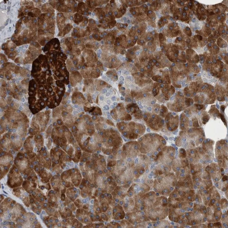Immunohistochemistry (Formalin/PFA-fixed paraffin-embedded sections) - Anti-USP25 antibody (AB246948)