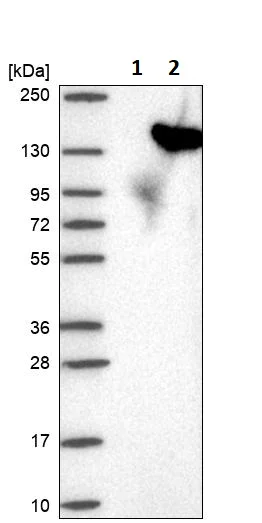 Western blot - Anti-USP25 antibody (AB246948)