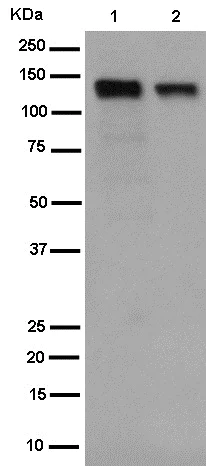 Western blot - Anti-USP25 antibody [EPR15019] - BSA and Azide free (AB250916)