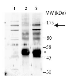 Immunoprecipitation - Anti-USP28 antibody (AB188240), expandable thumbnail