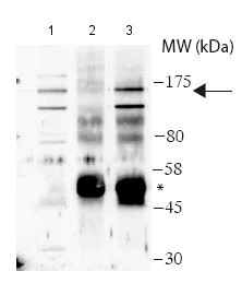 Immunoprecipitation - Anti-USP28 antibody (AB188240)