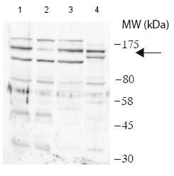 Western blot - Anti-USP28 antibody (AB188240), expandable thumbnail