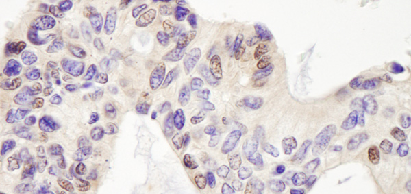 Immunohistochemistry (Formalin/PFA-fixed paraffin-embedded sections) - Anti-USP28 antibody (AB70893), expandable thumbnail