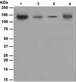 Western blot - Anti-USP28 antibody [EPR4250(2)] (AB110744), expandable thumbnail