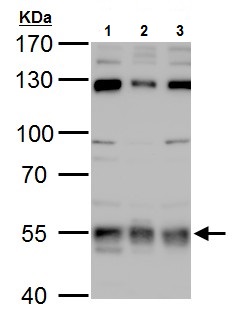 Western blot - Anti-USP3 antibody (AB229348), expandable thumbnail