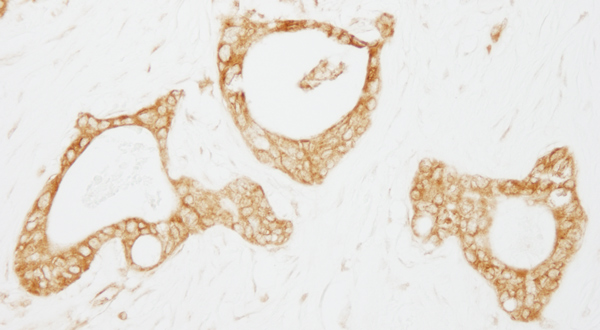 Immunohistochemistry (Formalin/PFA-fixed paraffin-embedded sections) - Anti-USP3 antibody (AB80597)