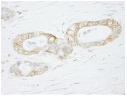 Immunohistochemistry (Formalin/PFA-fixed paraffin-embedded sections) - Anti-USP3 antibody (AB84702)