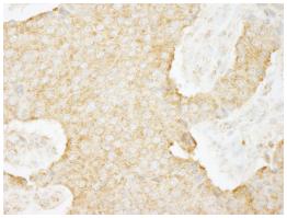 Immunohistochemistry (Formalin/PFA-fixed paraffin-embedded sections) - Anti-USP3 antibody (AB84702)