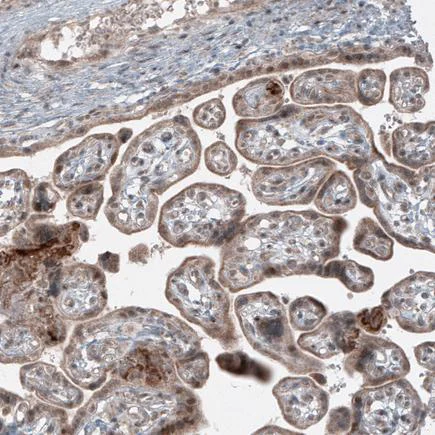 Immunohistochemistry (Formalin/PFA-fixed paraffin-embedded sections) - Anti-USP30 antibody [CL4438] (AB219969)
