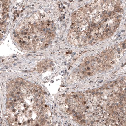 Immunohistochemistry (Formalin/PFA-fixed paraffin-embedded sections) - Anti-USP30 antibody [CL4438] (AB219969)