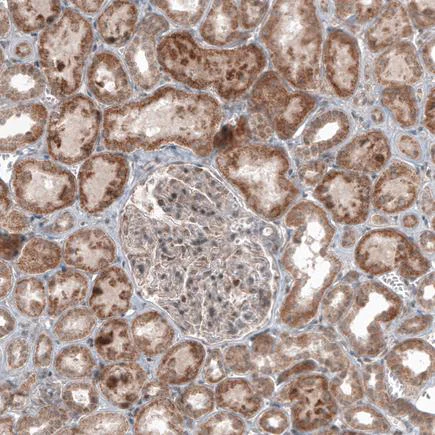 Immunohistochemistry (Formalin/PFA-fixed paraffin-embedded sections) - Anti-USP30 antibody [CL4438] (AB219969)