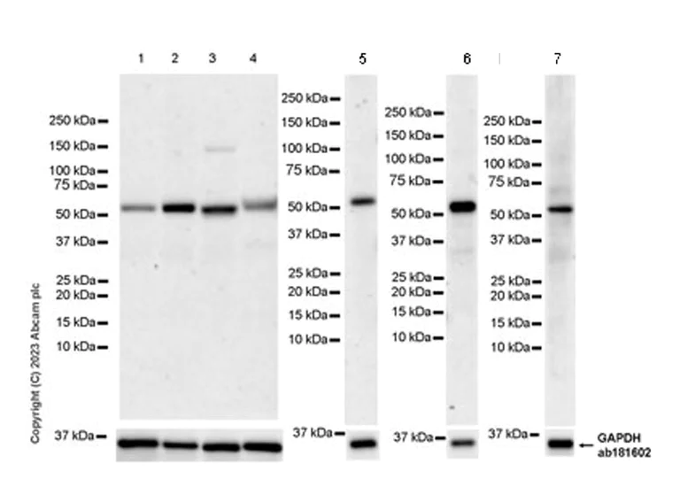 Western blot - Anti-USP30 antibody [EPR27024-81] - BSA and Azide free (AB314750)