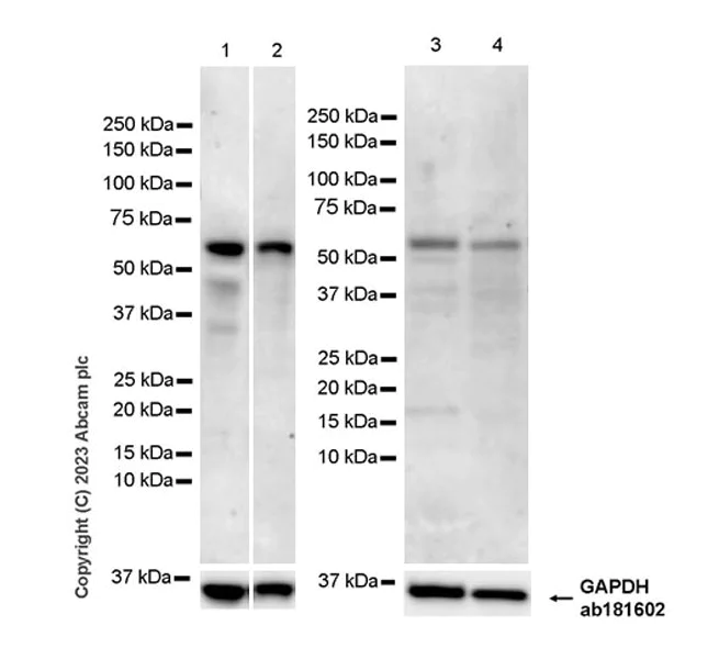 Western blot - Anti-USP30 antibody [EPR27024-81] - BSA and Azide free (AB314750)