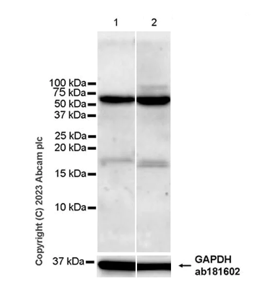 Western blot - Anti-USP30 antibody [EPR27024-81] - BSA and Azide free (AB314750)