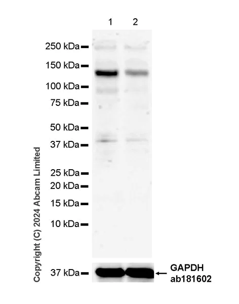 Western blot - Anti-USP31 + USP43 antibody [EPR26029-42] (AB320632)