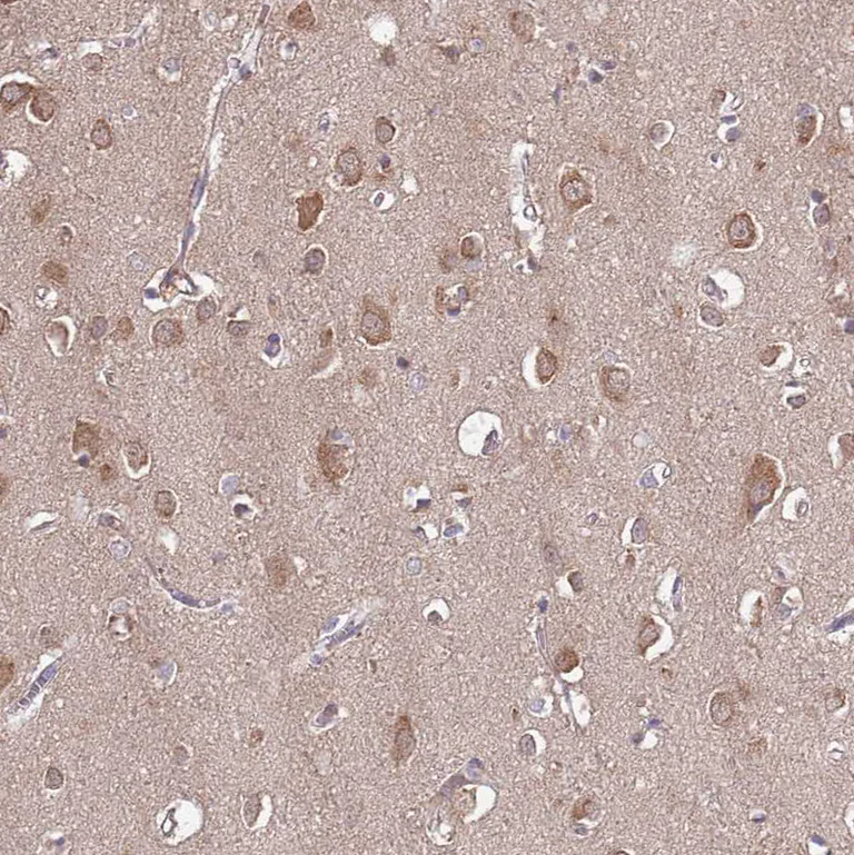 Immunohistochemistry (Formalin/PFA-fixed paraffin-embedded sections) - Anti-USP32 antibody (AB251903)