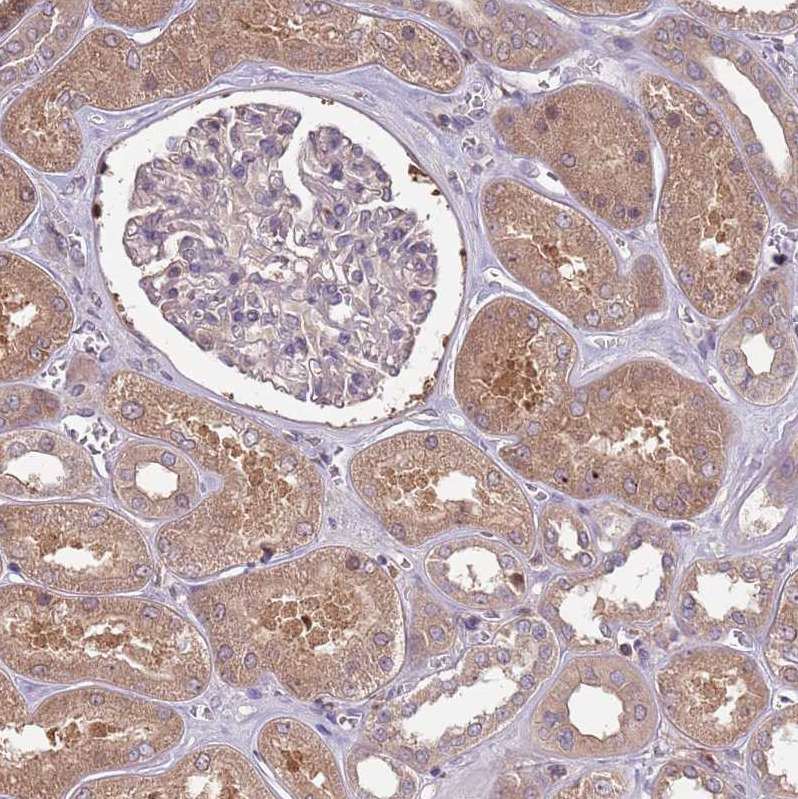 Immunohistochemistry (Formalin/PFA-fixed paraffin-embedded sections) - Anti-USP32 antibody (AB251903)