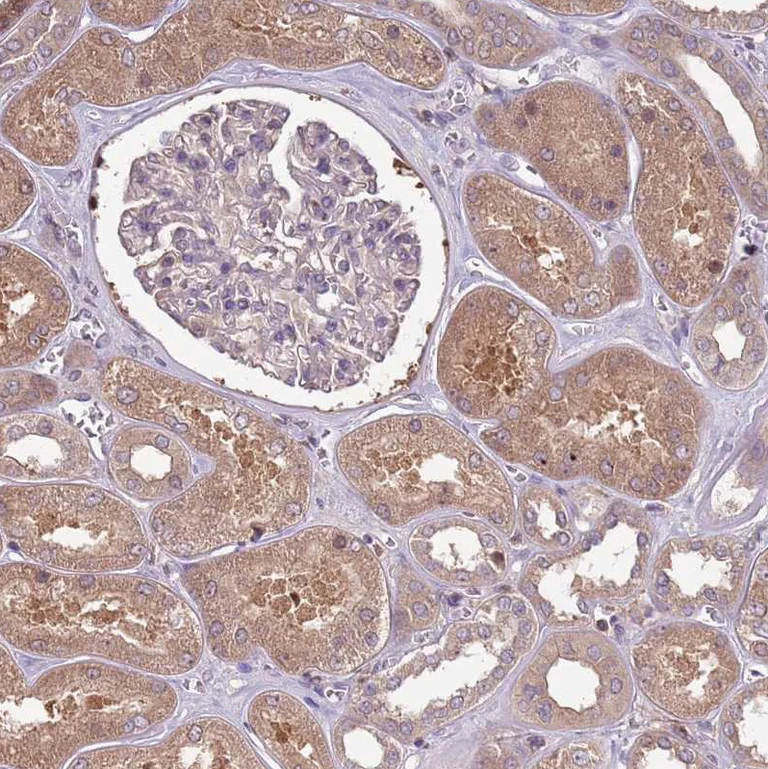 Immunohistochemistry (Formalin/PFA-fixed paraffin-embedded sections) - Anti-USP32 antibody (AB251903)
