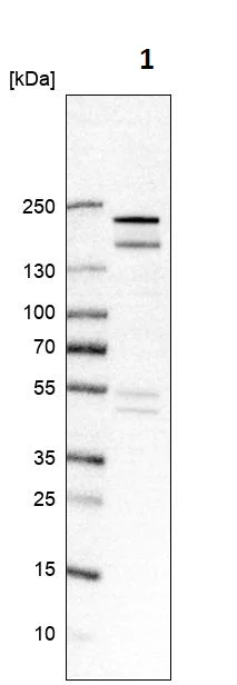 Western blot - Anti-USP32 antibody (AB251903)