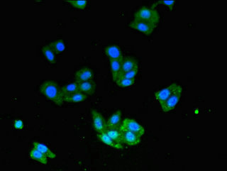 Immunocytochemistry/ Immunofluorescence - Anti-USP33 antibody (AB237510)