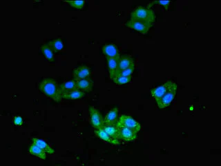 Immunocytochemistry/ Immunofluorescence - Anti-USP33 antibody (AB237510)