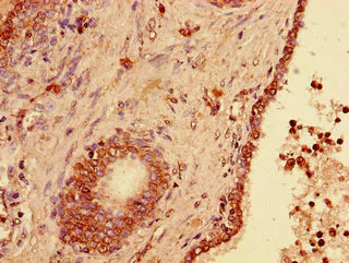 Immunohistochemistry (Formalin/PFA-fixed paraffin-embedded sections) - Anti-USP33 antibody (AB237510)