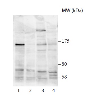 Western blot - Anti-USP37 antibody (AB190184), expandable thumbnail