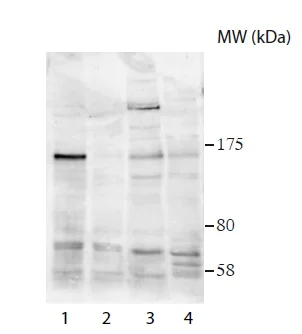 Western blot - Anti-USP37 antibody (AB190184)