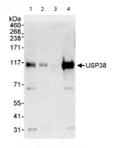 Western blot - Anti-USP38 antibody (AB72244)
