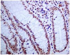 Immunohistochemistry (Formalin/PFA-fixed paraffin-embedded sections) - Anti-USP39 antibody [EPR8684] - BSA and Azide free (AB248411), expandable thumbnail