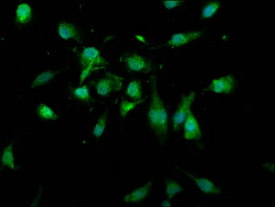 Immunocytochemistry/ Immunofluorescence - Anti-USP4 antibody (AB236987)