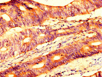 Immunohistochemistry (Formalin/PFA-fixed paraffin-embedded sections) - Anti-USP4 antibody (AB236987)