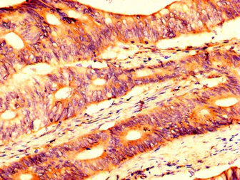 Immunohistochemistry (Formalin/PFA-fixed paraffin-embedded sections) - Anti-USP4 antibody (AB236987)