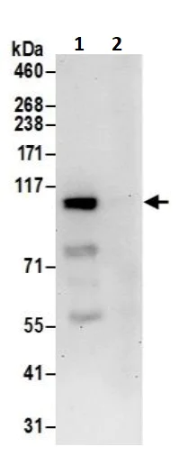 Immunoprecipitation - Anti-USP4 antibody (AB245654)