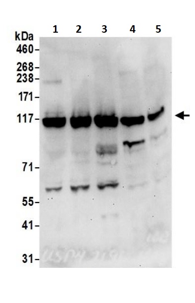 Western blot - Anti-USP4 antibody (AB245654)