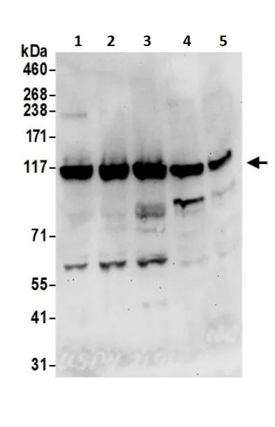 Western blot - Anti-USP4 antibody (AB245654)