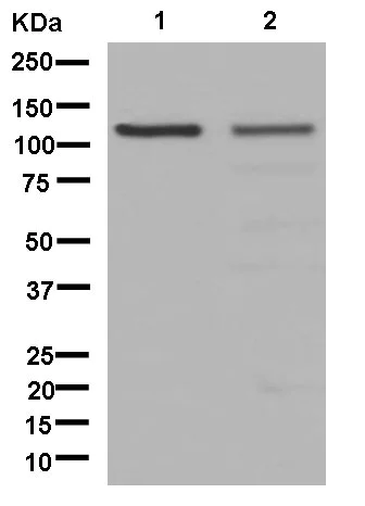 Western blot - Anti-USP4 antibody [EPR13846] (AB181105)